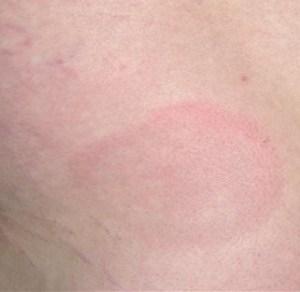 Archer USMLE Step 3 Questions