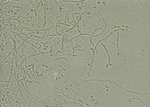 hyphae